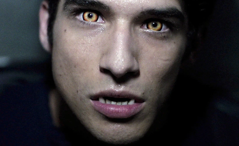 Kurt Adam Değil, Kurt Ergen: Teen Wolf