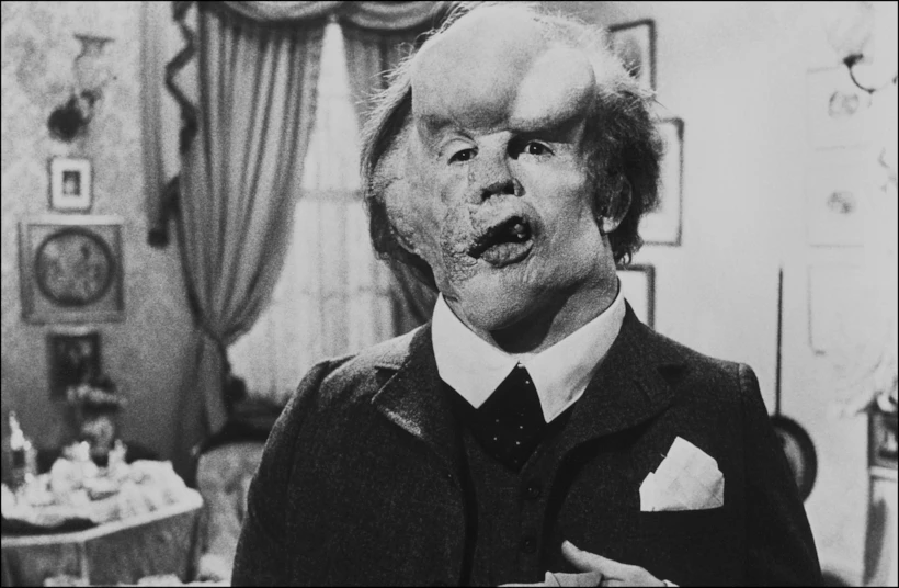 hurt – elephant man