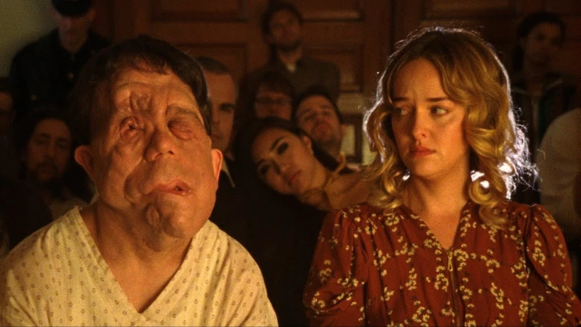 Chained For Life: Güzellik Kavramını Ters Yüz Eden Film