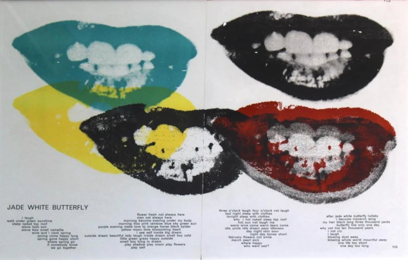 kiss-andyy